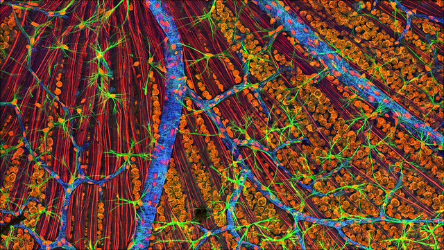 Das Foto zeigt Körperzellen unter dem Elektronenmikroskop